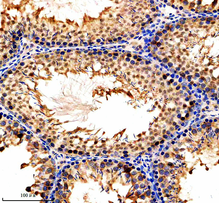 a13137 rbm27 primary antibodies ihc testing 4