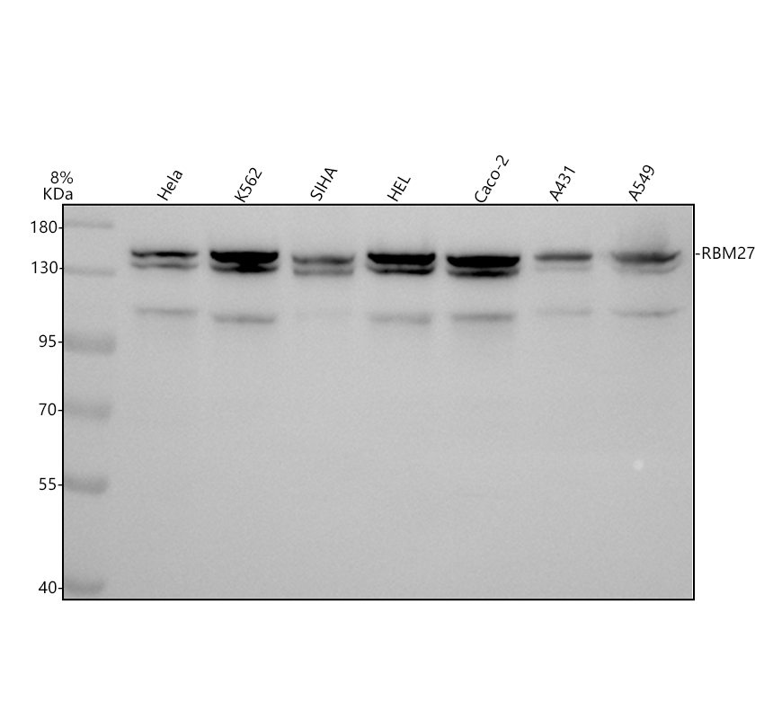 Western blot analysis of RBM27 using anti-RBM27 antibody (A13137)
