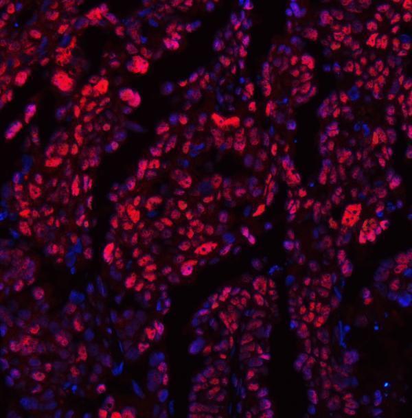 a13158 trmt6 primary antibodies if testing 11