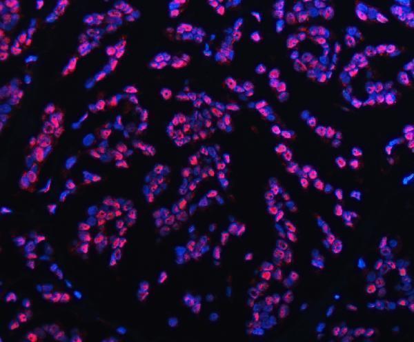 a13158 trmt6 primary antibodies if testing 12