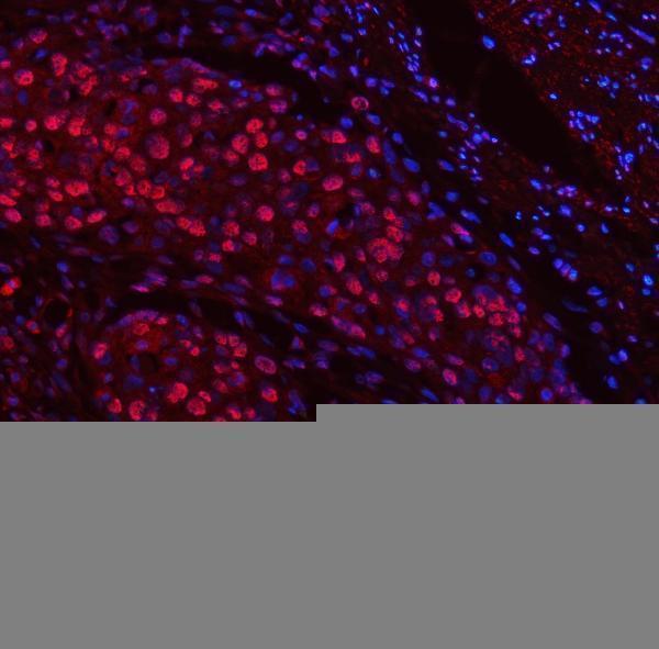 a13158 trmt6 primary antibodies if testing 13