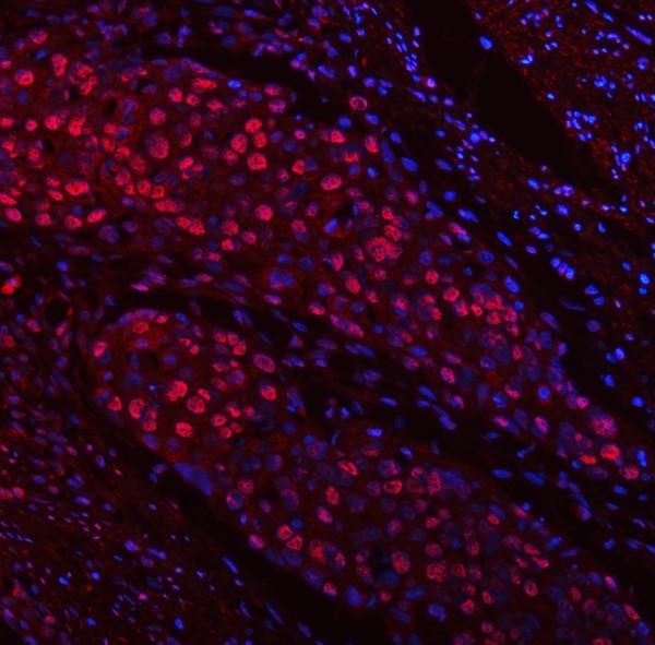 a13158 trmt6 primary antibodies if testing 13_1
