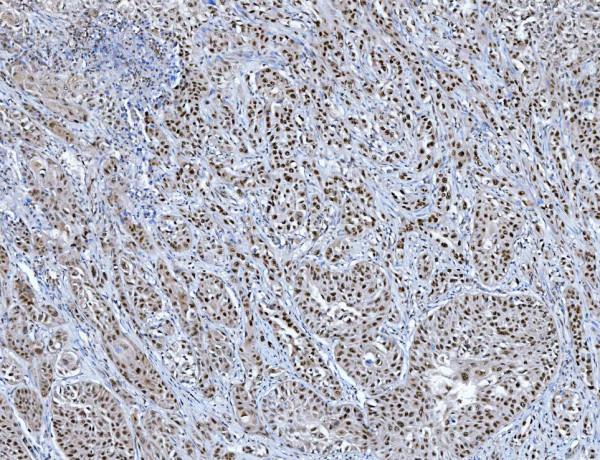 a13158 trmt6 primary antibodies ihc testing 2_1