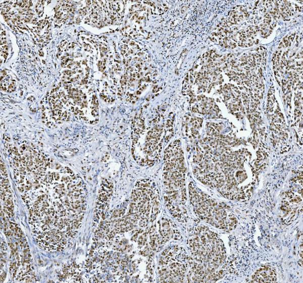 a13158 trmt6 primary antibodies ihc testing 3_1