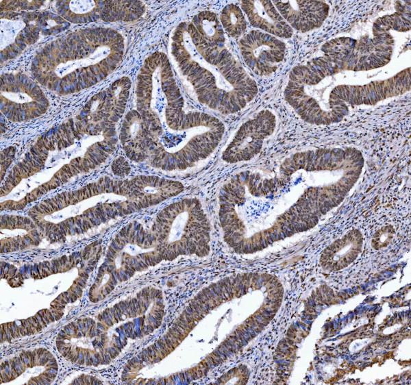 a13158 trmt6 primary antibodies ihc testing 4_1