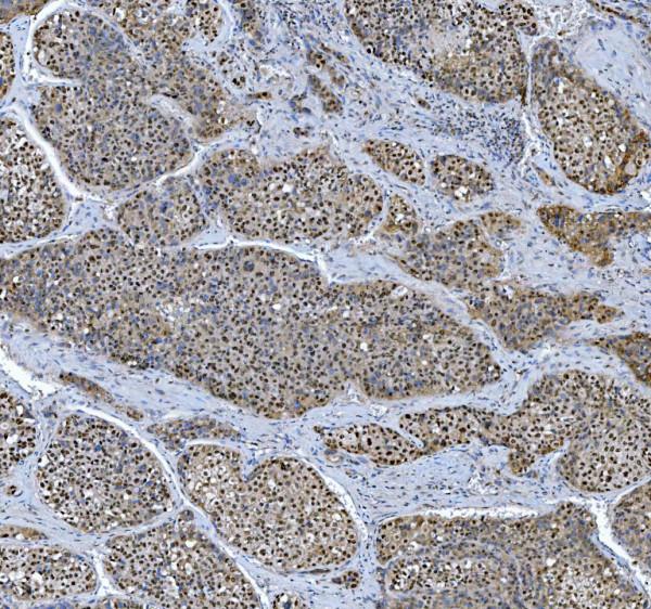 a13158 trmt6 primary antibodies ihc testing 5_1