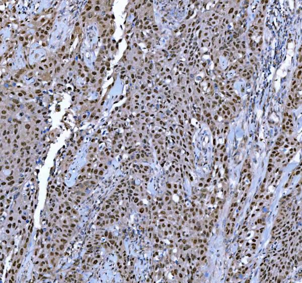 a13158 trmt6 primary antibodies ihc testing 6_1