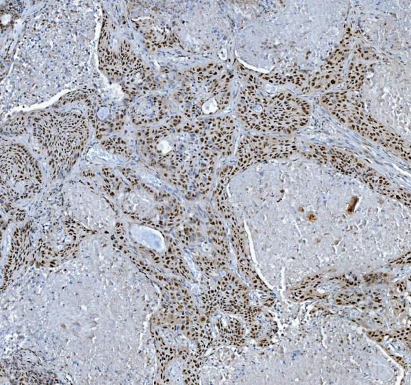 a13158 trmt6 primary antibodies ihc testing 8_1
