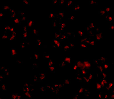 Immunofluorescence of TMEM214 in A20 cells with TMEM214 antibody at 20 μg/mL