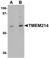 Western blot analysis of TMEM214 in A20 cell lysate with TMEM214 antibody at (A) 1 and (B) 2 μg/mL