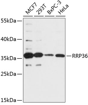 a13160 rrp36 primary antiboties wb testing 1