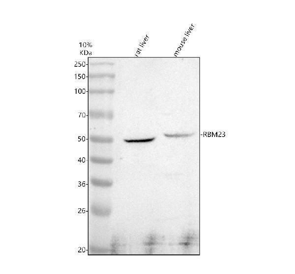 Western blot analysis of RBM23 using anti-RBM23 antibody (A13166-1)
