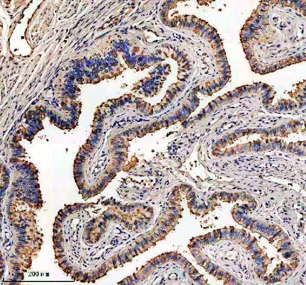 IHC analysis of TPPP3 using anti-TPPP3 antibody (A13192-1)