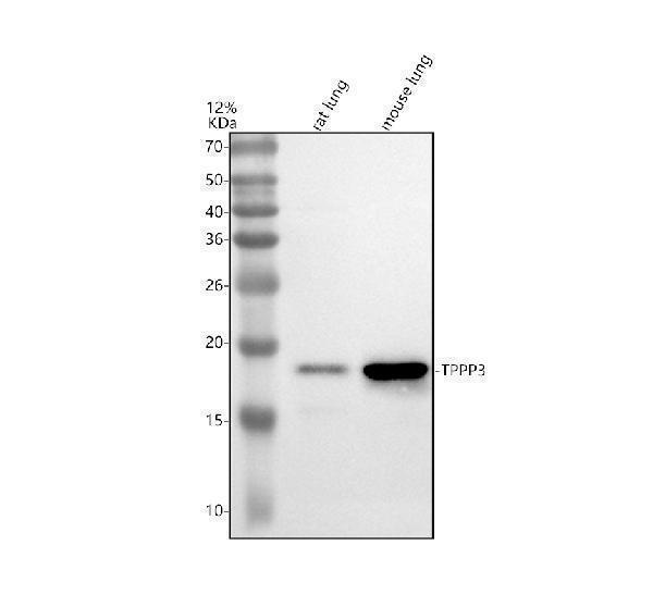Western blot analysis of TPPP3 using anti-TPPP3 antibody (A13192-1)