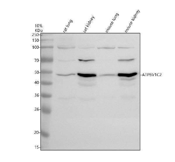 Western blot analysis of ATP6V1C2 using anti-ATP6V1C2 antibody (A13193-2)