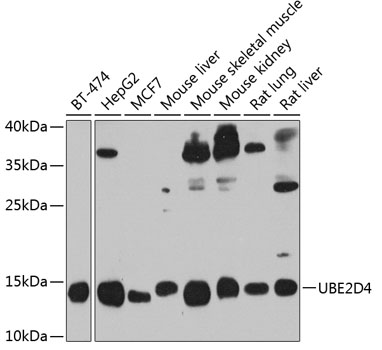a13194 ube2d4 primary antiboties wb testing 1