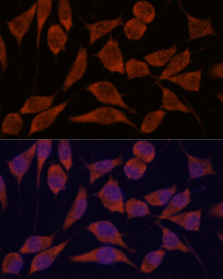Immunofluorescence analysis of L929 cells using TRAPPC6A antibody  at dilution of 1:100