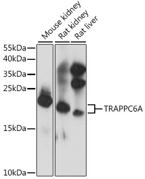 Western blot analysis of extracts of various cell lines, using TRAPPC6A antibody  at 1:1000 dilution