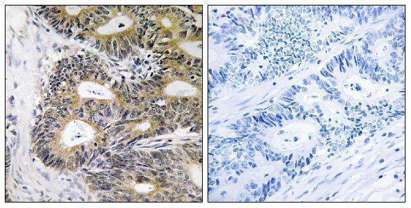 a13195 trappc6a primary antibodies ihc testing 1