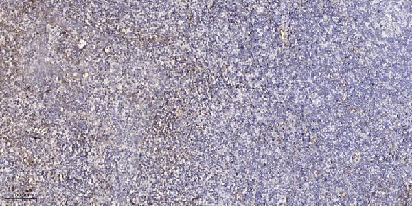 a13201 1 zadh2 primary antibodies ihc testing 1