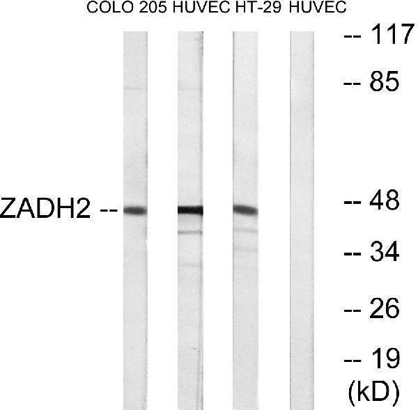 a13201 1 zadh2 primary antibodies wb testing 2