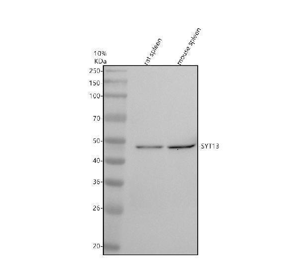 Western blot analysis of SYT13 using anti-SYT13 antibody (A13202-2)
