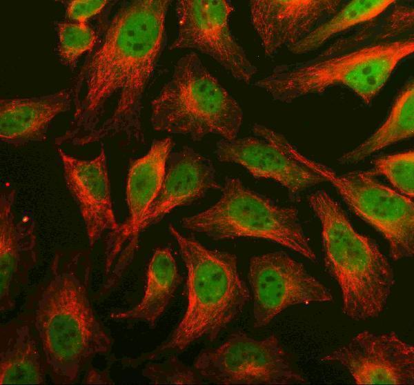  IF analysis of PRDM6 using anti-PRDM6 antibody (A13216-1) and anti-Beta Tubulin antibody (M01857-3)