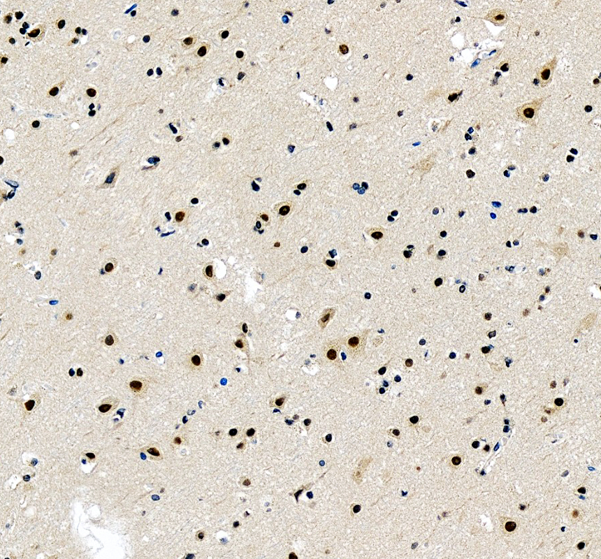 a13216 1 prdm6 primary antibodies ihc testing 1