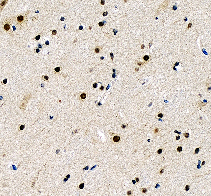 a13216 1 prdm6 primary antibodies ihc testing 2