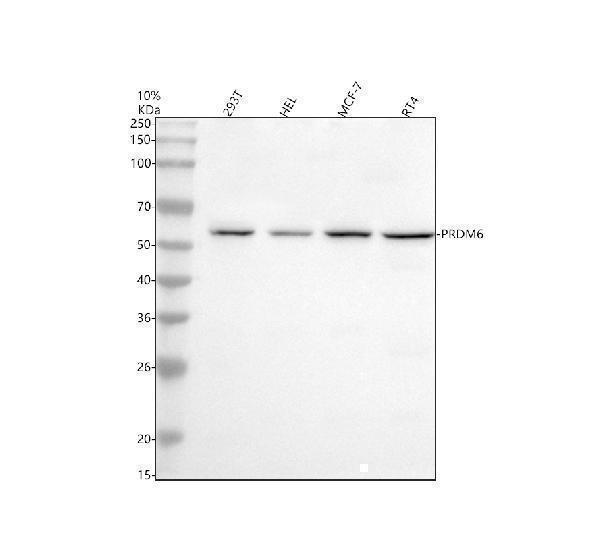  Western blot analysis of PRDM6 using anti-PRDM6 antibody (A13216-1)