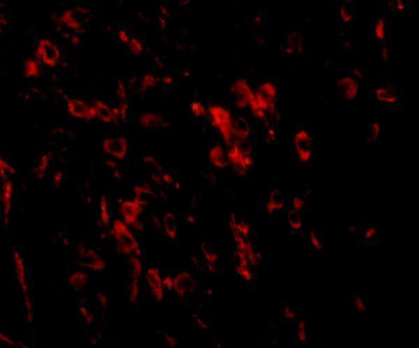 a13222 lrfn1 primary antibodies if testing 3