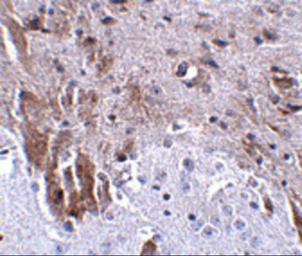 a13222 lrfn1 primary antibodies ihc testing 2