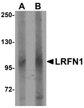 a13222 lrfn1 primary antibodies wb testing 1