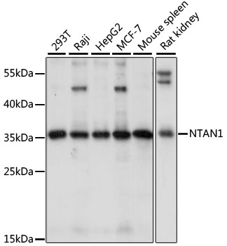 a13223 ntan1 primary antiboties wb testing 1