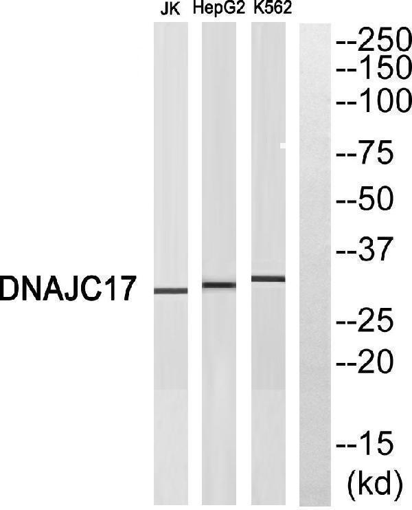 Western blot analysis of DNAJC17 Antibody