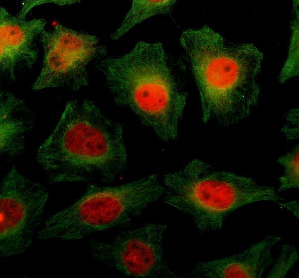 IF analysis of DNAJC17 using anti-DNAJC17 antibody (A13225-2) and anti-Alpha Tubulin antibody (M03989-3)
