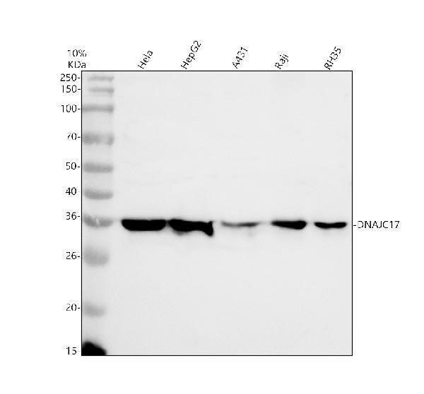 Western blot analysis of DNAJC17 using anti-DNAJC17 antibody (A13225-2)