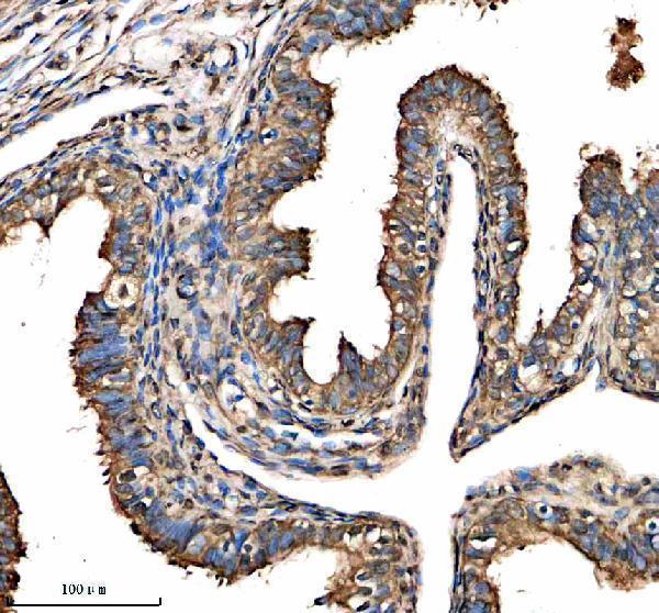 a13227 1 fbxo21 primary antibodies ihc testing 1