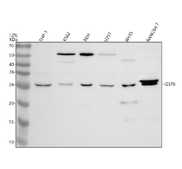 Western blot analysis of IGSF6 using anti-IGSF6 antibody (A13228)
