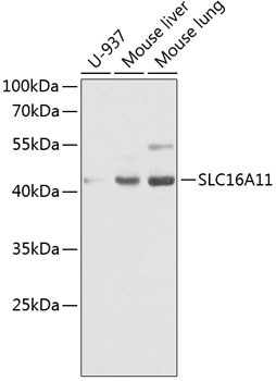 Western blot analysis of extracts of various cell lines, using SLC16A11 antibody  at 1:1000 dilution