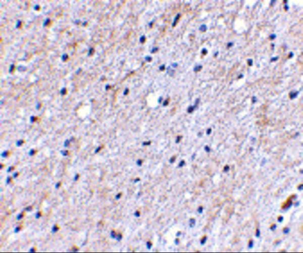 Immunohistochemical staining of human brain tissue using Nipsnap antibody at 2