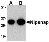 Western blot analysis of NIPSNAP in human brain tissue lysate with NIPSNAP antibody at (A) 0