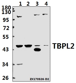 a13241 1 tbpl2 primary antiboties wb testing 1