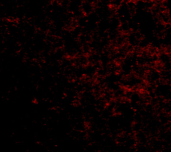 Immunofluorescence of LGI2 in Human Brain cells with LGI2 antibody at 5 μg/mL