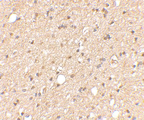 Immunohistochemical staining of human brain tissue using LGI2 antibody at 2