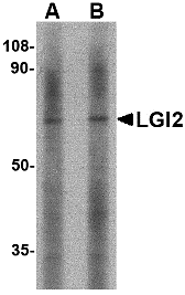 Western blot analysis of LGI2 in mouse liver tissue lysate with LGI2 antibody at (A) 1 and (B) 2 μg/mL