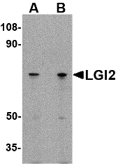 a13256 lgi2 primary antibodies wb testing 1