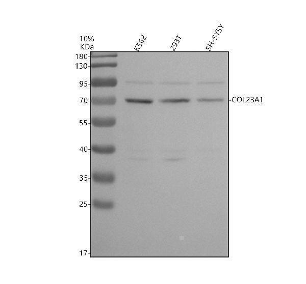 Western blot analysis of COL23A1 using anti-COL23A1 antibody (A13263-2)
