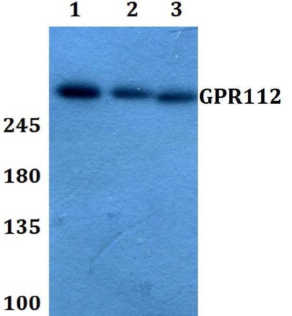 Western blot (WB) analysis of GPR112 polyclonal antibody at 1:500 dilution
Lane1:A549 whole cell lysate
Lane2:Raw264