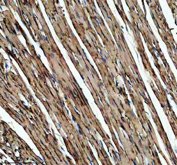IHC analysis of FBXO40 using anti-FBXO40 antibody (A13273-1)